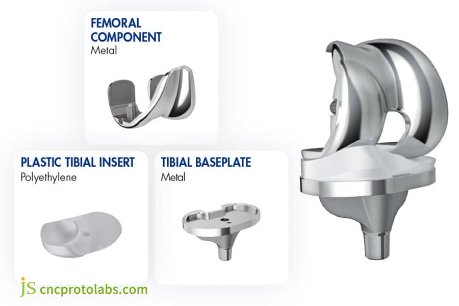 Diagrama de peças usinadas personalizadas para implante de joelho.
