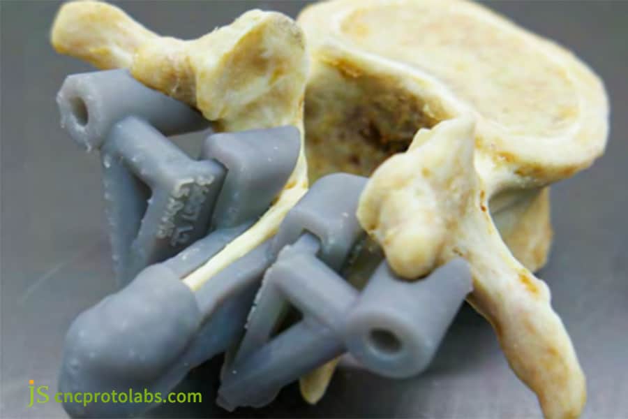 medical device rapid prototyping